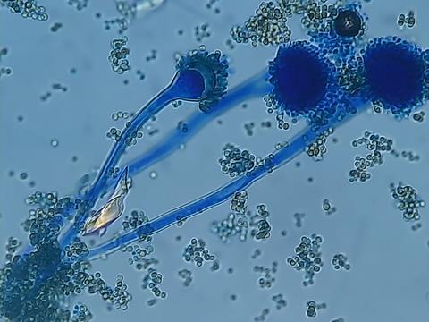 Conidia,_sterigma,_vesicle,_and_conidiophore_of_Aspergillus