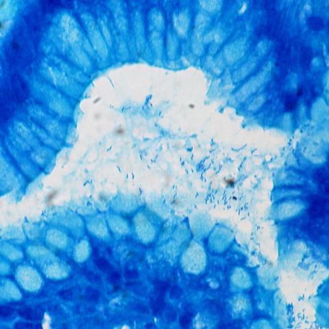Helicobacter_pylori,_Gastric_Biopsy,_Giemsa_Stain_(5517582111)