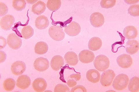 Trypanosoma forms in blood smear