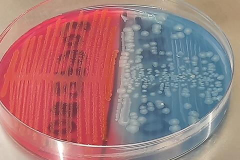 Lactose-fermenting_(LF)_strain_and_non-lactose_fermenting(NLF)_strain_of_E._coli_colony_morphology_on_CLED_medium