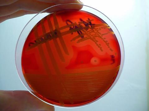 Staphylococcus_aureus-blood_agar-_hemolysis_detail