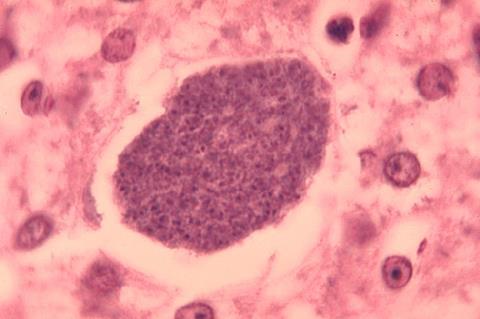 Histopathology_of_malaria_exoerythrocytic_forms_in_liver_07G0024_lores