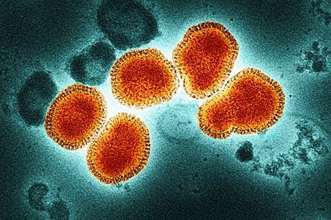 Influenza_A_Virus_(H3N2)_(52747876754)