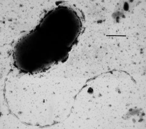Dvulgaris_micrograph (2)