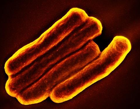 Mycobacterium_Tuberculosis_Bacteria,_the_Cause_of_TB_(52766234426)