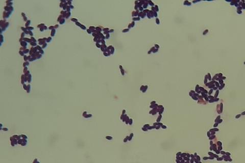 Enterococcus_faecium_in_Gram_Staining_of_culture