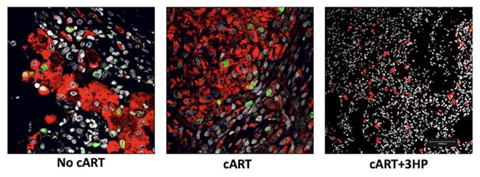 Low-Res_macrophages-sm