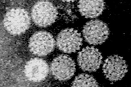 Papilloma_Virus_(HPV)_EM_(new_version)