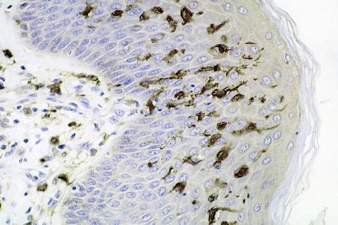 Dendritic_cells