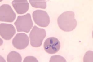 Babesia_microti_CDC