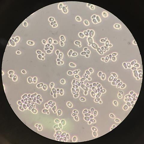 Saccharomyces_cerevisiae_100x_phase-contrast_microscopy2 (1)