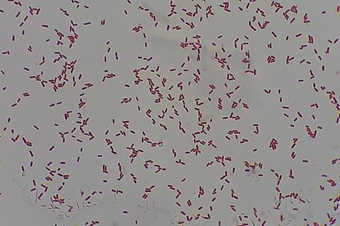 Gram_Negative_bacilli_of_Klebsiella_in_Gram_stained_smear_of_culture