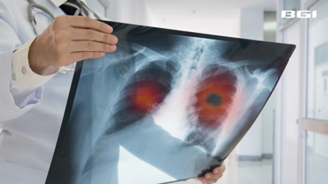 Low-Res_250523_BGI Genomics mNGS lung infection research