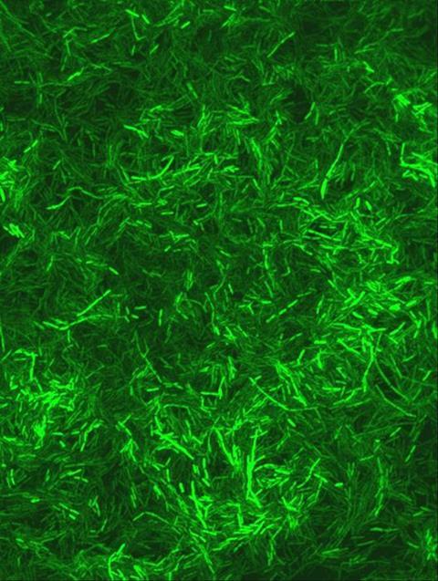 Low-Res_Pradeep Singh Micrograph 2