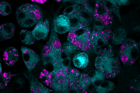 Low-Res_A confocal microscopy image of macrophages treated with MTX (cyan) that have eaten bacteria (magenta).png