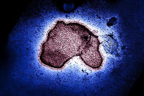 Human_Respiratory_Syncytial_Virus_(RSV)_-_2111