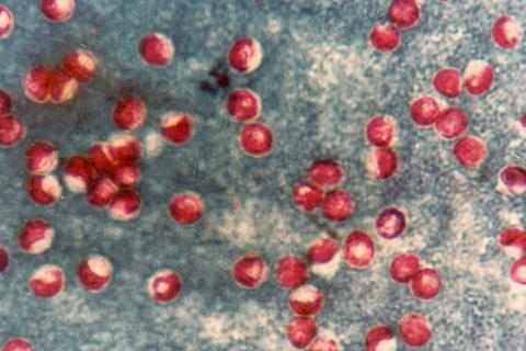 Cryptosporidium_Ziehl_Alae_Gati