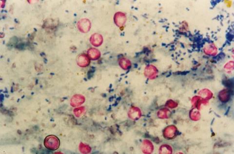 Cryptosporidium_parvum_02