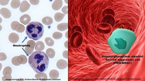 Low-Res_Michael May 22 Neutrophils and PMN-MDSC