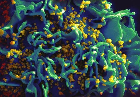 HIV-infected_H9_T_cell_(6813403685)