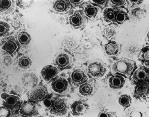Herpes_simplex_virus_TEM_B82-0474_lores (3)