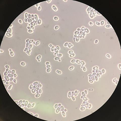 Saccharomyces_cerevisiae_100x_phase-contrast_microscopy