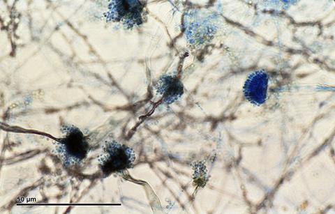 Aspergillus_fumigatus_(257_15)