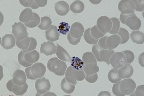 P._vivax_-_schizonts