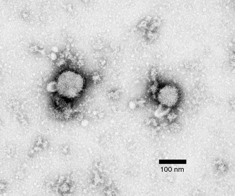 Lymphocytic_choriomeningitis_virus