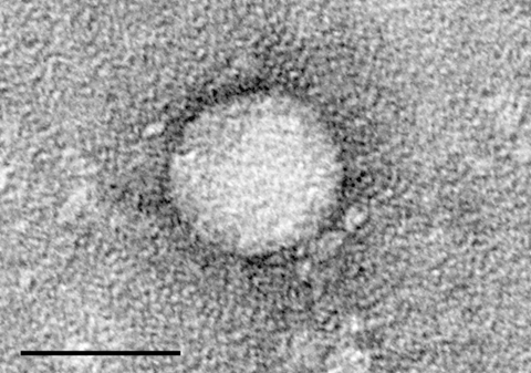 HCV_EM_picture_2