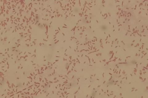 Gram_Negative_Rods_of_Aeromonas_hydrophila