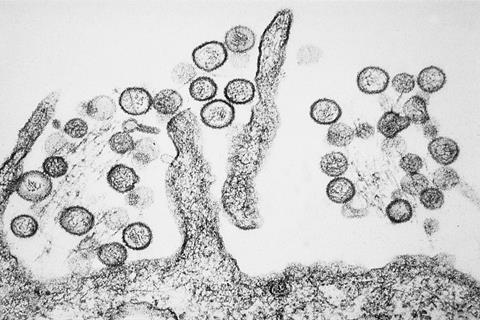 Sin_Nombre_hanta_virus