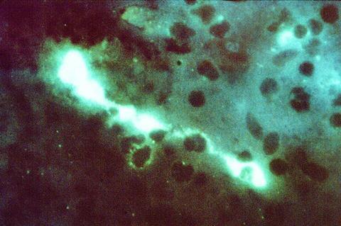 Chlamydophila_psittaci_FA_stain