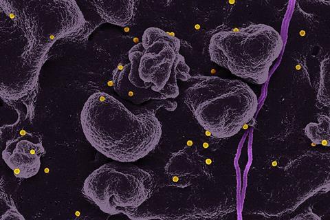 Crimean-Congo_Hemorrhagic_Fever_(CCHF)_Virus_(41541604722)