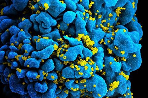 960px-HIV-infected_T_cell_(6813384933)
