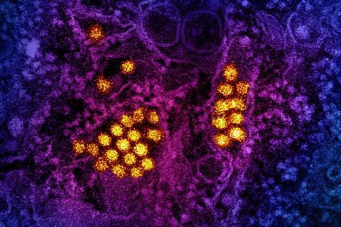 Dengue_Virus_Particles_(53231044882) (1)