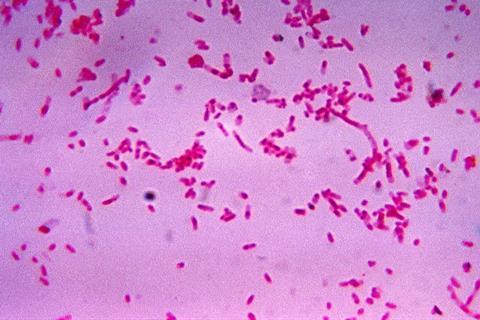 Fusobacterium_novum_01 (1)