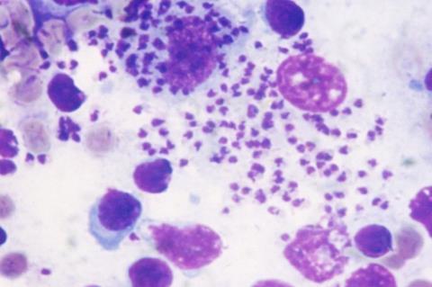 703px-Leishmania_infantum (1)