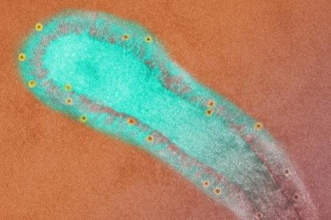 Human_Respiratory_Syncytial_Virus_(RSV)_(52453014952) (1)