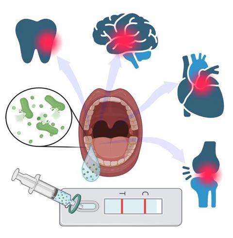 Low-Res_Steckl-Gingivitis