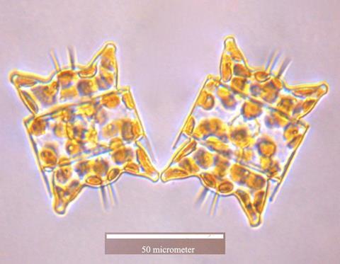 771px-Odontella_aurita_cells
