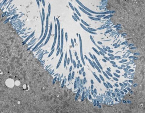 Low-Res_Human nasal organoids with cilia CREDIT Julien Amat & Bao Wang