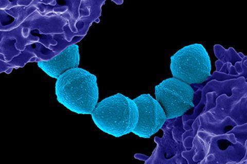 Streptococcus_Pyogenes_(Group_A_Strep)_(52602554746)