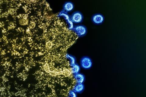 HIV_Virus_Particles_-_53567924670