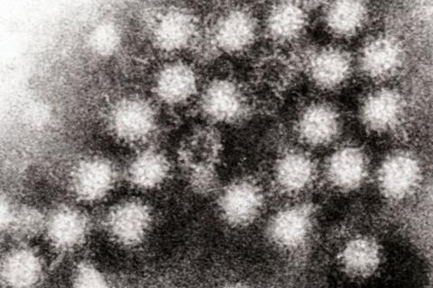 685px-Norovirus_4