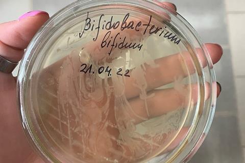 Bifidobacterium_bifidum,_рост_в_чашках