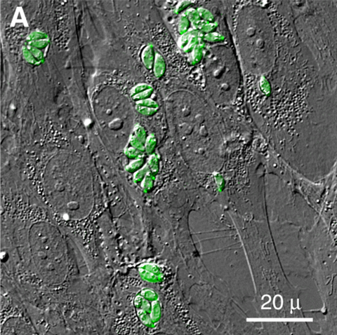 T-gondii_Intracelular