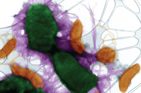 Low-Res_amyloid