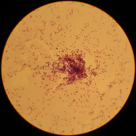 Lactococcus_lactis