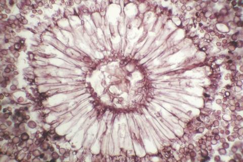 Aspergillus_-_Conidial_head_(5414785274)